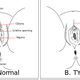An illustration of female genital mutilation types 1-111, as defined by the World Health Organization (Via Wikipedia, Wikimedia commons, creator: Kaylima)